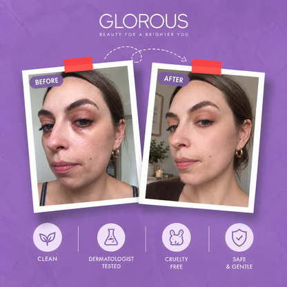 GLOROUS EYE REVIVE™